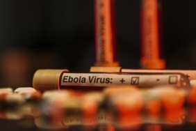 Kongo-Demokratik-Cumhuriyetindeki-Ebola-vakalari-7-bin-404e-yukseldi-featured