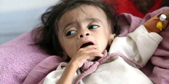 BMden-Yemende-insani-kriz-uyarisi-featured